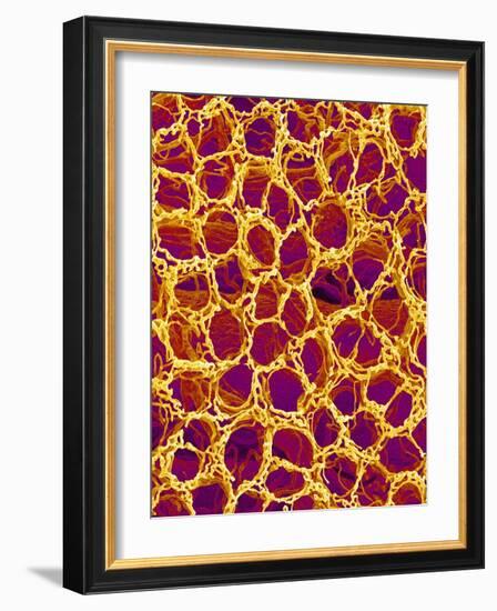 Blood Vessel Cast from Stomach of a Rat-Micro Discovery-Framed Photographic Print