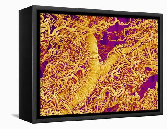 Blood Vessel Cast in Connective Tissue of a Rat-Micro Discovery-Framed Premier Image Canvas