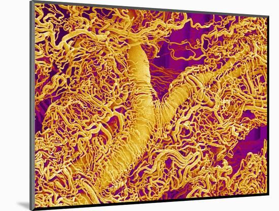 Blood Vessel Cast in Connective Tissue of a Rat-Micro Discovery-Mounted Photographic Print