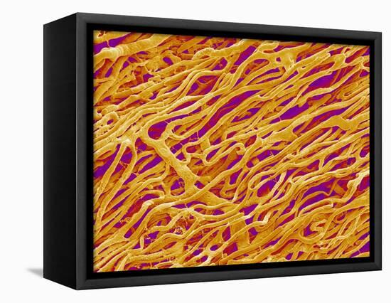 Blood Vessel Cast in Heart of a Rat-Micro Discovery-Framed Premier Image Canvas