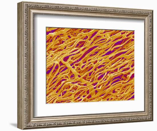 Blood Vessel Cast in Heart of a Rat-Micro Discovery-Framed Photographic Print