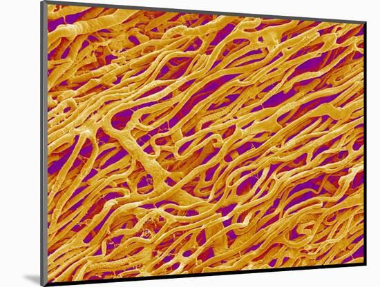 Blood Vessel Cast in Heart of a Rat-Micro Discovery-Mounted Photographic Print