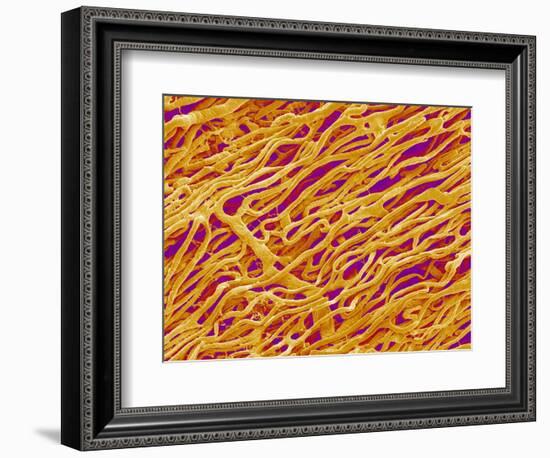 Blood Vessel Cast in Heart of a Rat-Micro Discovery-Framed Photographic Print