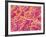 Blood Vessel Cast of Connective Tissue of a Rat-Micro Discovery-Framed Photographic Print