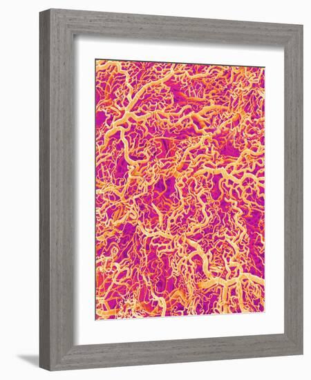 Blood Vessel Cast of Connective Tissue of a Rat-Micro Discovery-Framed Photographic Print