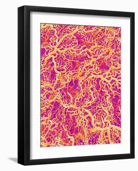 Blood Vessel Cast of Connective Tissue of a Rat-Micro Discovery-Framed Photographic Print