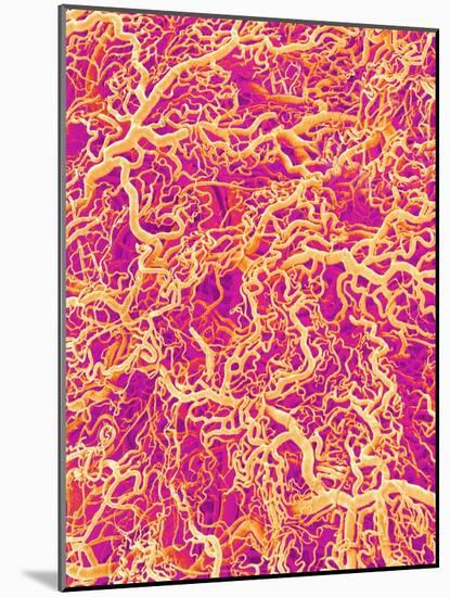Blood Vessel Cast of Connective Tissue of a Rat-Micro Discovery-Mounted Photographic Print