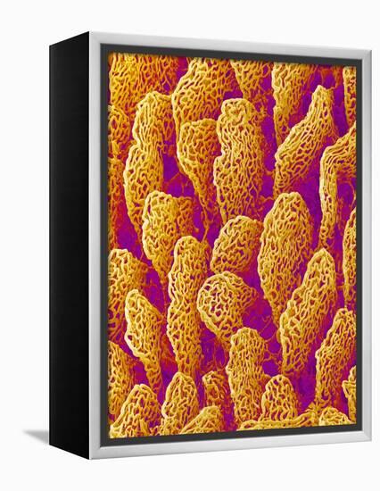 Blood Vessel Cast of the Duodenum of a Rat-Micro Discovery-Framed Premier Image Canvas