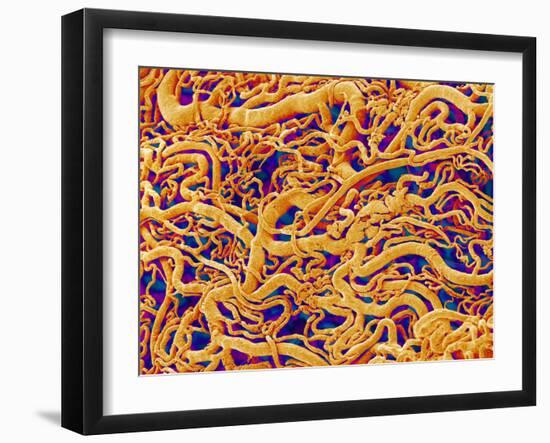 Blood Vessel Cast, SEM-Susumu Nishinaga-Framed Photographic Print