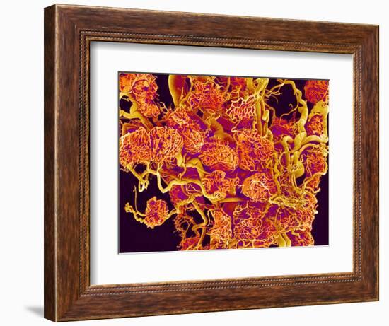 Blood Vessels and Corpus Luteum in Ovary of a Frog-Micro Discovery-Framed Photographic Print