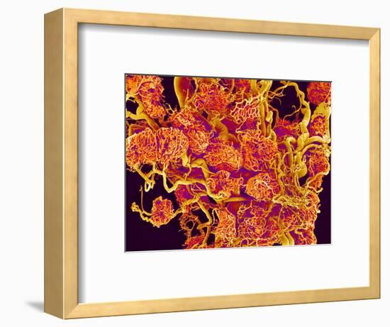 Blood Vessels and Corpus Luteum in Ovary of a Frog-Micro Discovery-Framed Photographic Print