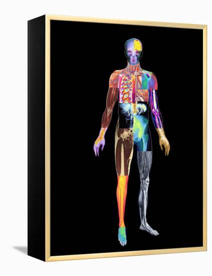 Body Imaging-Mehau Kulyk-Framed Premier Image Canvas