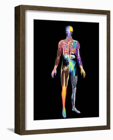 Body Imaging-Mehau Kulyk-Framed Photographic Print