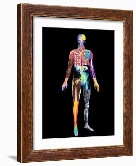 Body Imaging-Mehau Kulyk-Framed Photographic Print