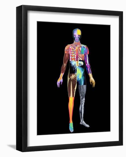 Body Imaging-Mehau Kulyk-Framed Photographic Print