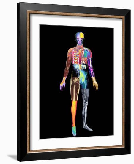 Body Imaging-Mehau Kulyk-Framed Photographic Print