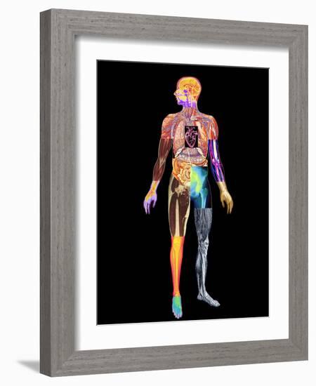 Body Imaging-Mehau Kulyk-Framed Photographic Print