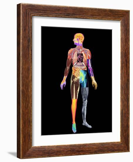 Body Imaging-Mehau Kulyk-Framed Photographic Print