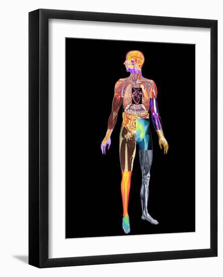 Body Imaging-Mehau Kulyk-Framed Photographic Print