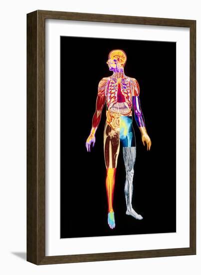 Body Imaging-Mehau Kulyk-Framed Photographic Print