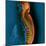 Bone Cancer, MRI-Du Cane Medical-Mounted Premium Photographic Print