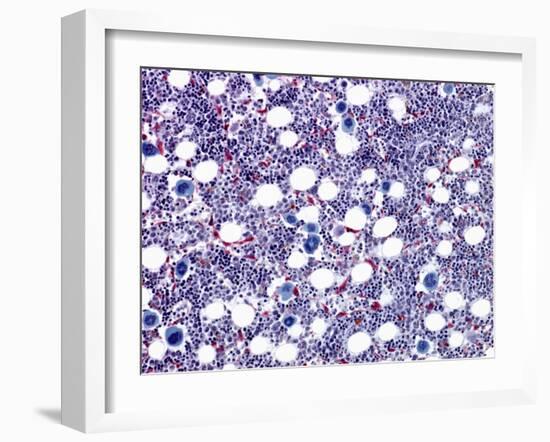 Bone Marrow, Light Micrograph-Steve Gschmeissner-Framed Photographic Print