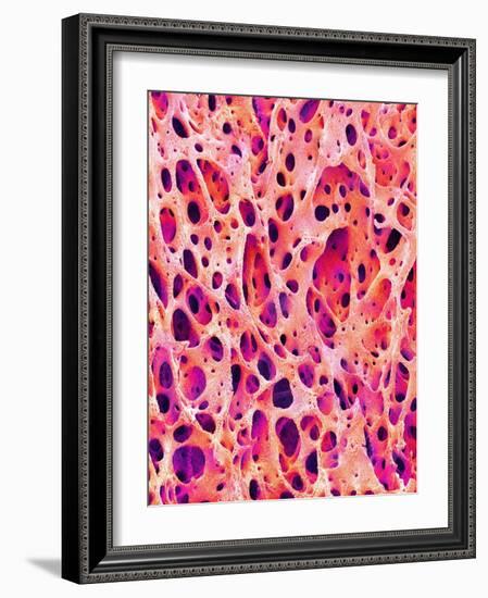 Bone Tissue of Chicken-Micro Discovery-Framed Photographic Print