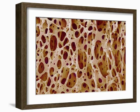 Bone Tissue-Susumu Nishinaga-Framed Photographic Print