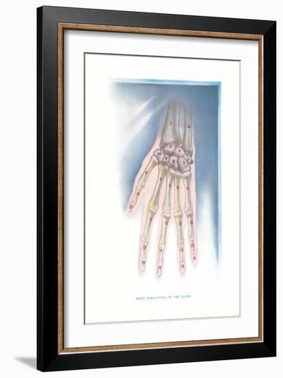 Bones of the Hand-null-Framed Art Print