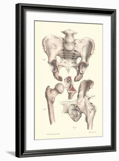 Bones of the Pelvis, Lower Spine, and Upper Leg-Found Image Press-Framed Giclee Print