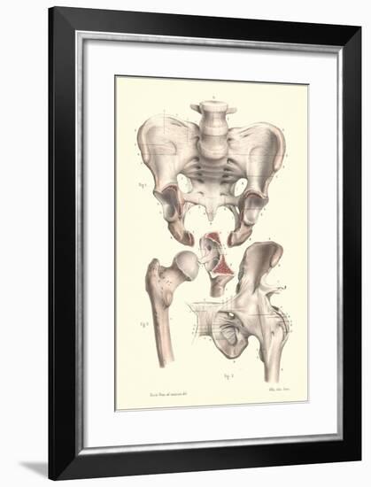 Bones of the Pelvis, Lower Spine, and Upper Leg-Found Image Press-Framed Giclee Print