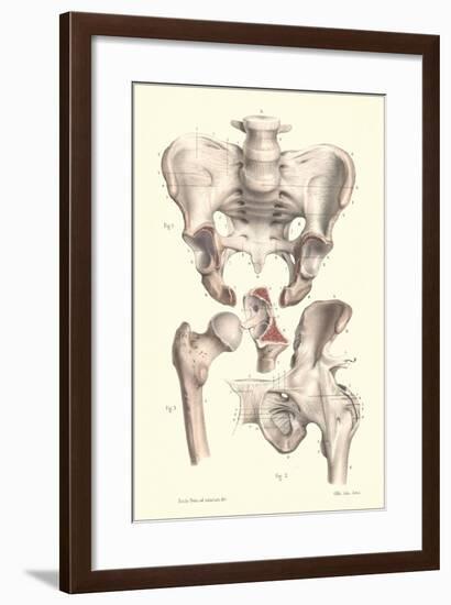 Bones of the Pelvis, Lower Spine, and Upper Leg-Found Image Press-Framed Giclee Print