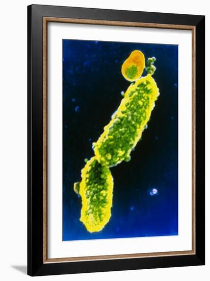 Bordetella Pertussis Bacteria-null-Framed Photographic Print