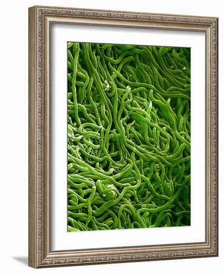 Borrelia Bacteria, SEM-Biomedical Imaging-Framed Photographic Print