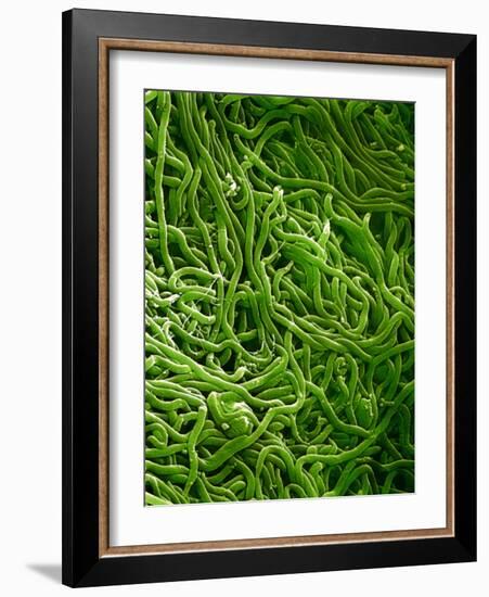 Borrelia Bacteria, SEM-Biomedical Imaging-Framed Photographic Print