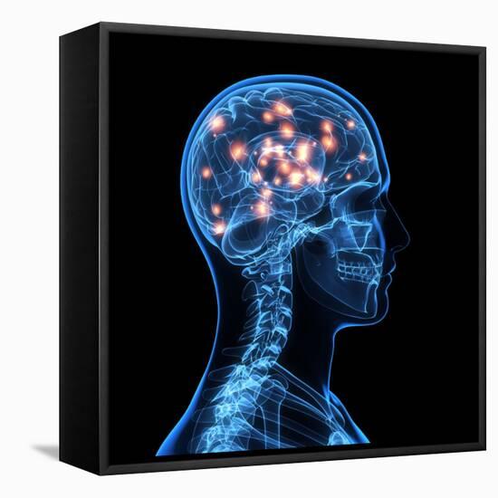 Brain Activity, Artwork-SCIEPRO-Framed Premier Image Canvas