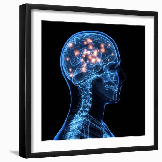 Brain Activity, Artwork-SCIEPRO-Framed Premium Photographic Print