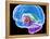 Brain Anatomy, Artwork-Roger Harris-Framed Premier Image Canvas