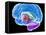 Brain Anatomy, Artwork-Roger Harris-Framed Premier Image Canvas