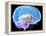 Brain Anatomy, Artwork-Roger Harris-Framed Premier Image Canvas