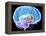 Brain Anatomy, Artwork-Roger Harris-Framed Premier Image Canvas