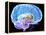 Brain Anatomy, Artwork-Roger Harris-Framed Premier Image Canvas