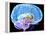 Brain Anatomy, Artwork-Roger Harris-Framed Premier Image Canvas