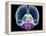 Brain Anatomy, Artwork-Roger Harris-Framed Premier Image Canvas