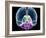 Brain Anatomy, Artwork-Roger Harris-Framed Photographic Print