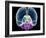 Brain Anatomy, Artwork-Roger Harris-Framed Photographic Print