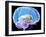 Brain Anatomy, Artwork-Roger Harris-Framed Photographic Print