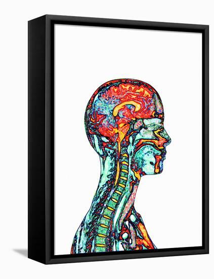 Brain And Spinal Cord, MRI-Mehau Kulyk-Framed Premier Image Canvas