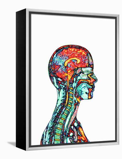 Brain And Spinal Cord, MRI-Mehau Kulyk-Framed Premier Image Canvas