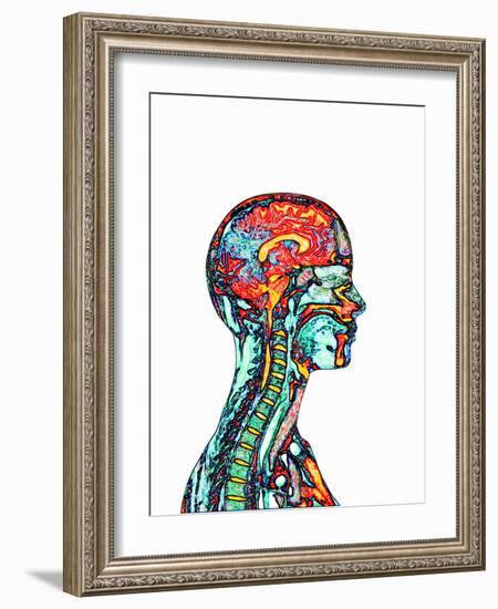 Brain And Spinal Cord, MRI-Mehau Kulyk-Framed Photographic Print